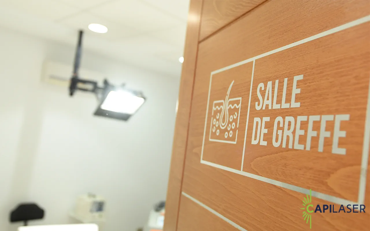 Salle de greffe de cheveux