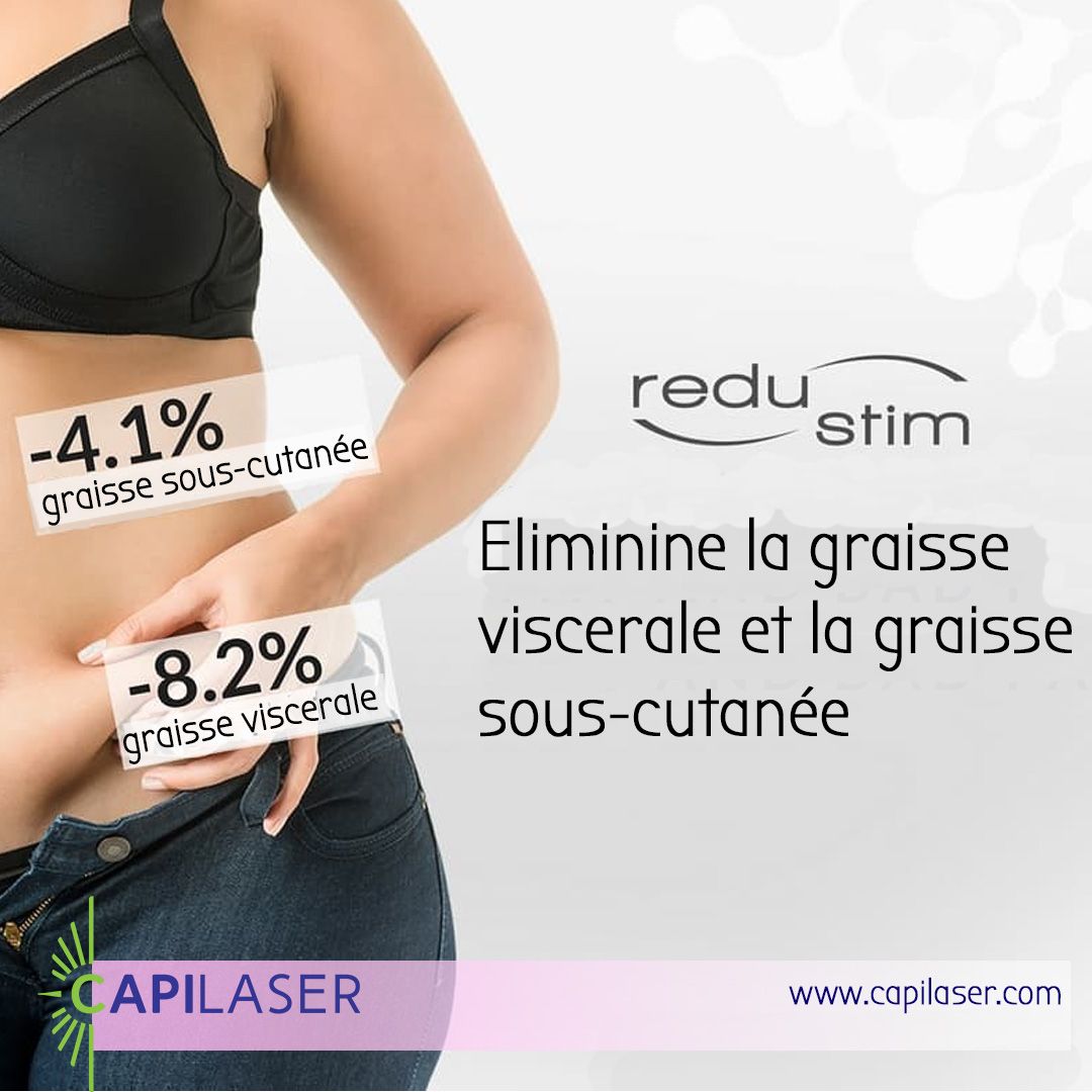 Déstockage des graisses